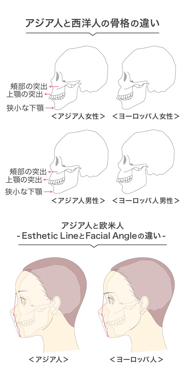 アジア人と西洋人の骨格の違い アジア人と欧米人 -Esthetic LineとFacial Angleの違い-