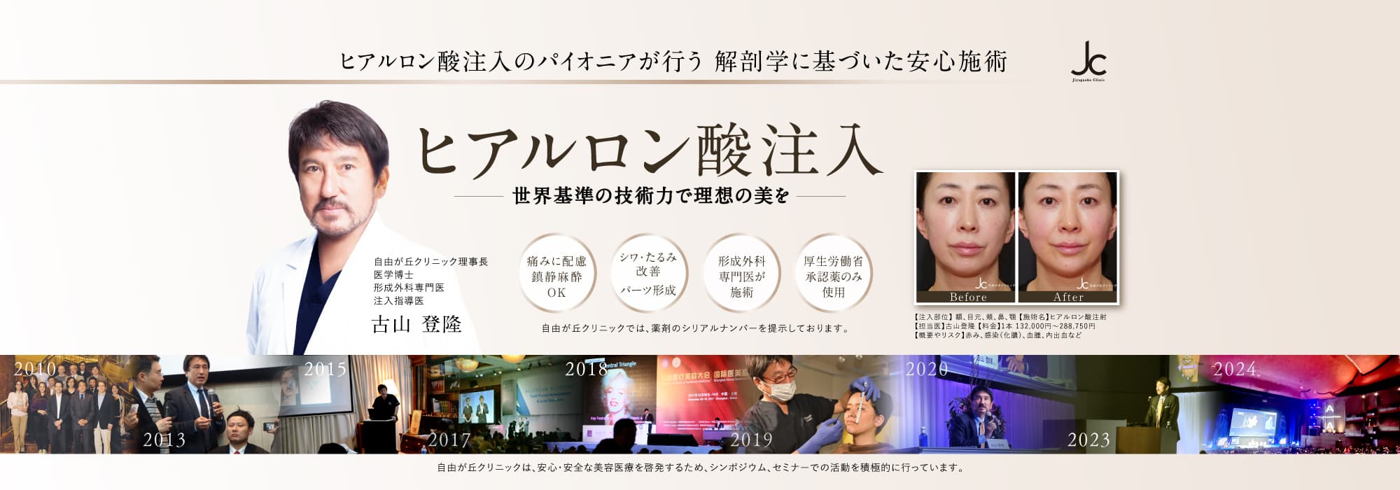 自由が丘クリニックのヒアルロン酸注射