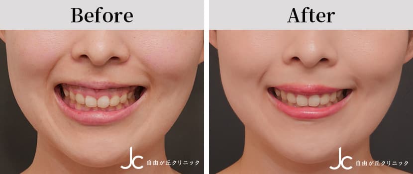 症例写真
