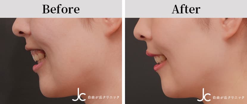 症例写真