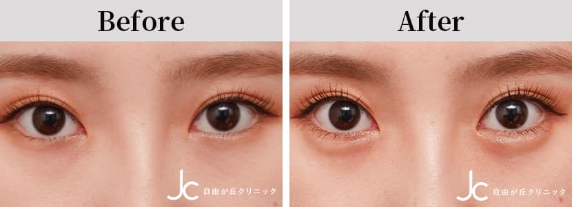 症例写真