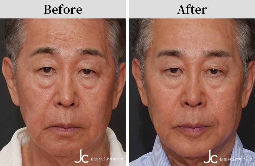 症例写真