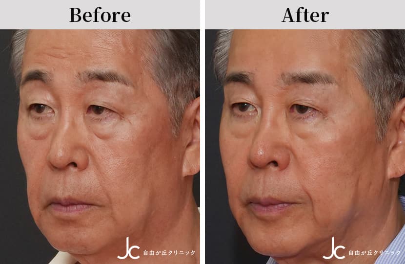 症例写真