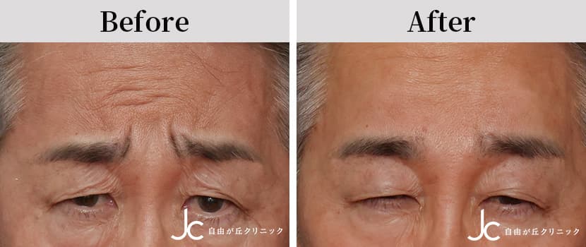 症例写真