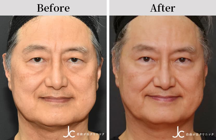 症例写真