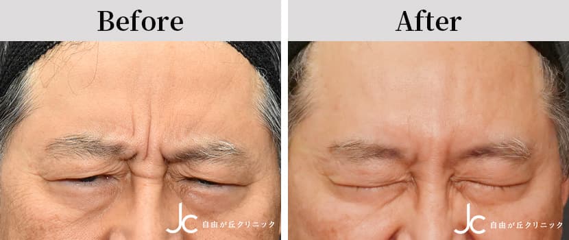 症例写真