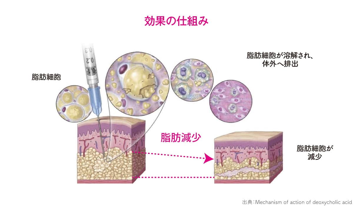 チンセラプラスの効果の仕組み