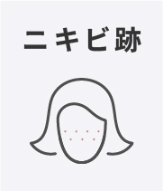 ニキビ跡