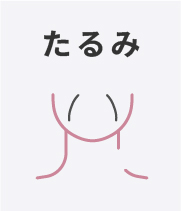 たるみ