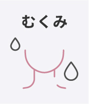 むくみ