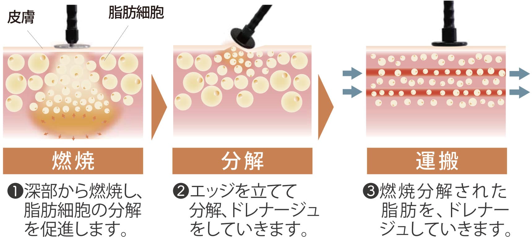 ラフォスの効果
