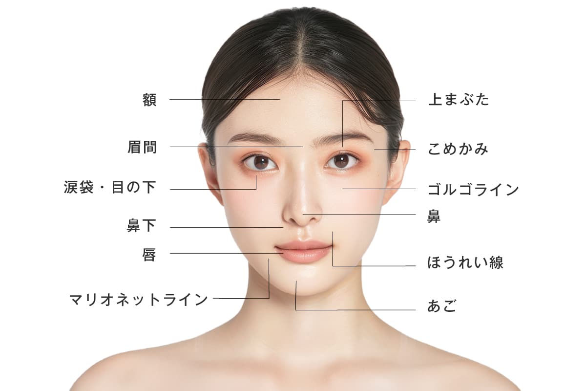 ヒアルロン酸の注入部位のイメージ写真