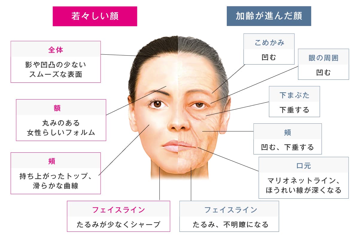 若々しい顔と加齢が進んだ顔の比較イラスト