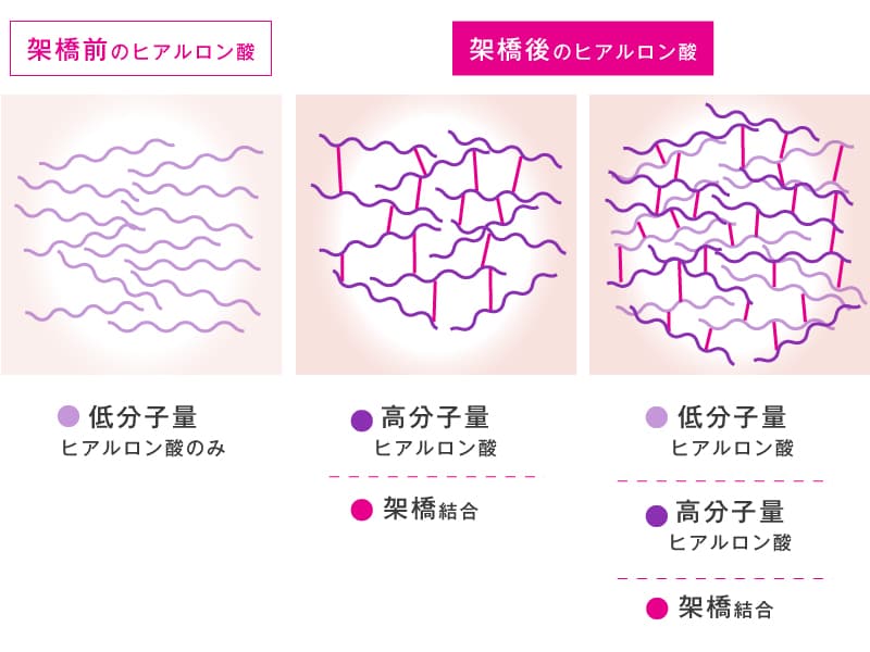 ヒアルロン酸架橋のイラスト