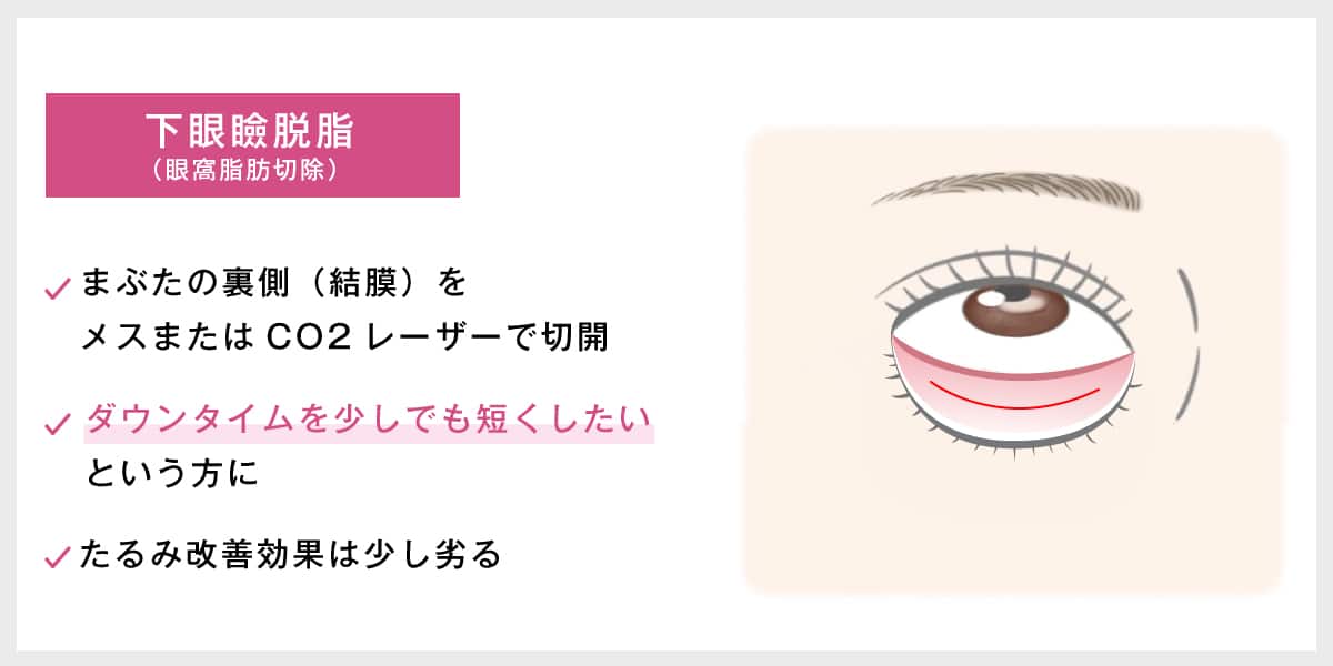 下眼瞼脱脂（眼窩脂肪切除）の解説イラスト