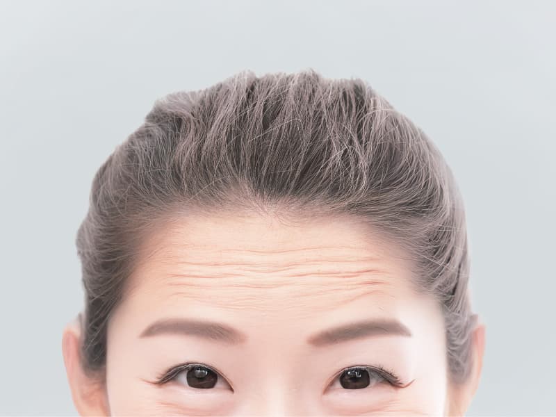 額のシワが目立つ女性