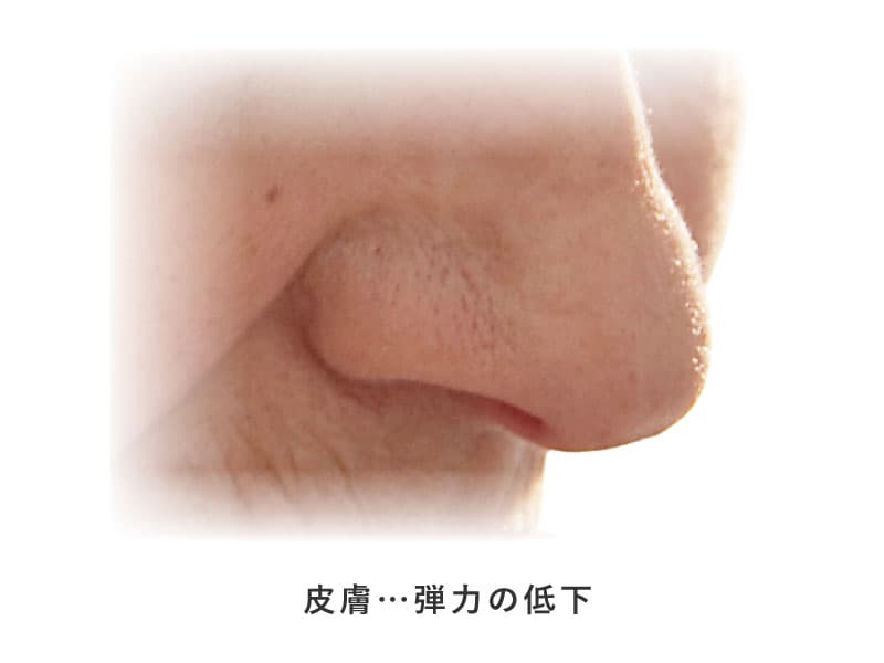 中年層の方の鼻の写真