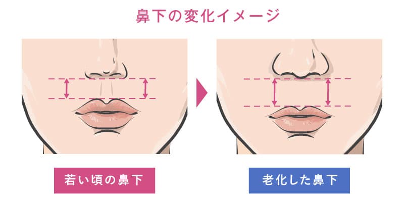 加齢による鼻下の変化のイメージイラスト