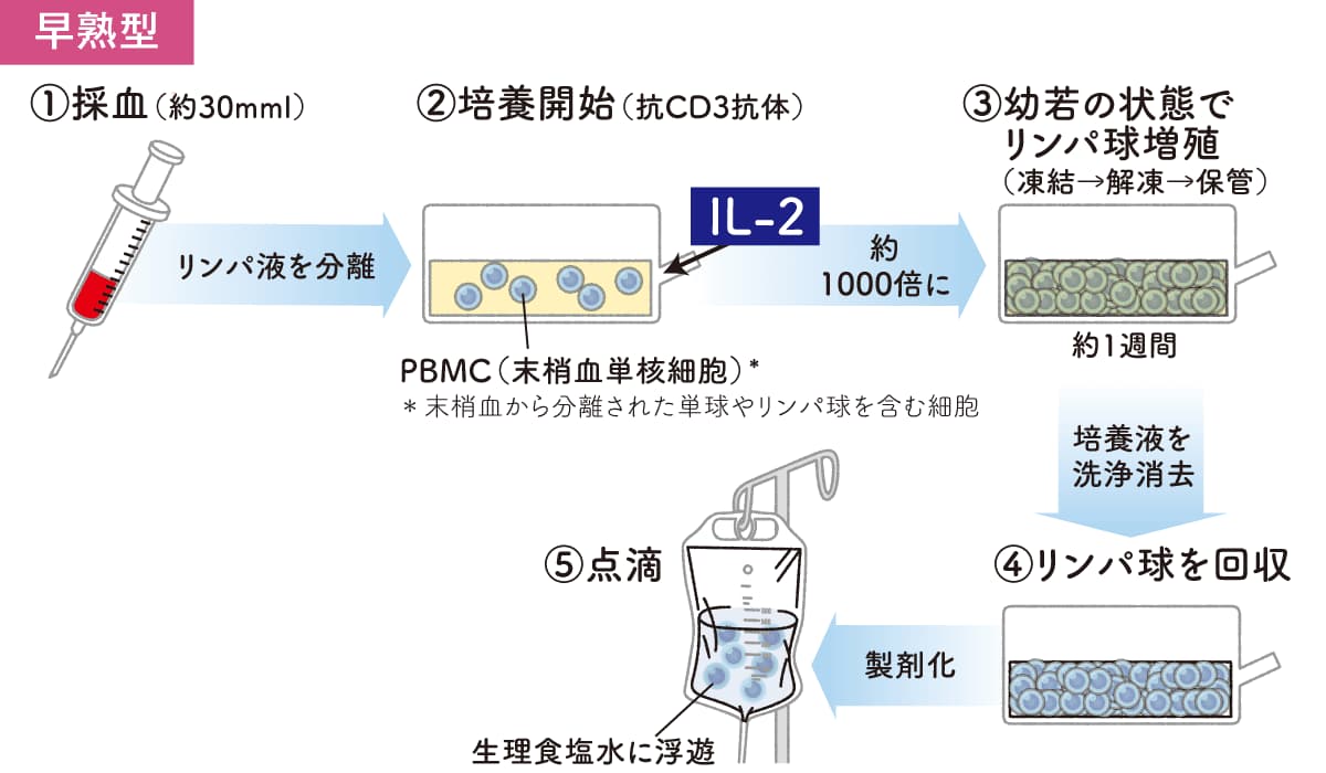 早熟型自己リンパ球療法の培養から点滴までの流れ