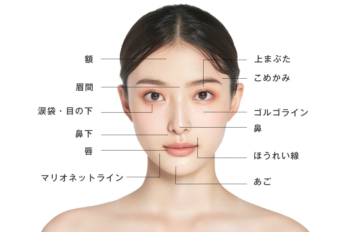 ヒアルロン酸の注入部位のイメージ写真