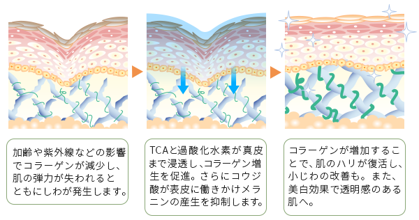 マッサージピールの作用