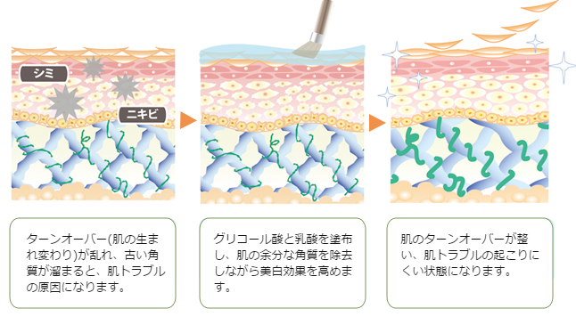 ケミカルピーリングの作用