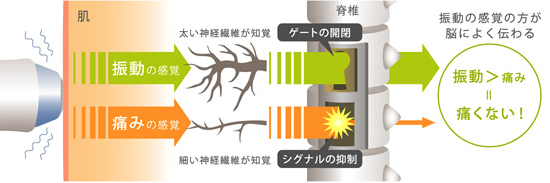痛みを軽減させるポイント図解