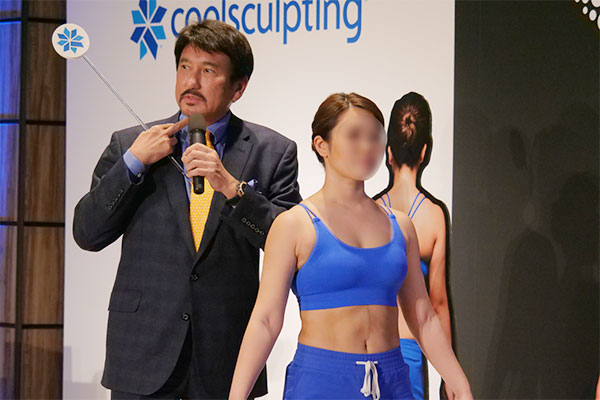 クールスカルプティングプレス発表会