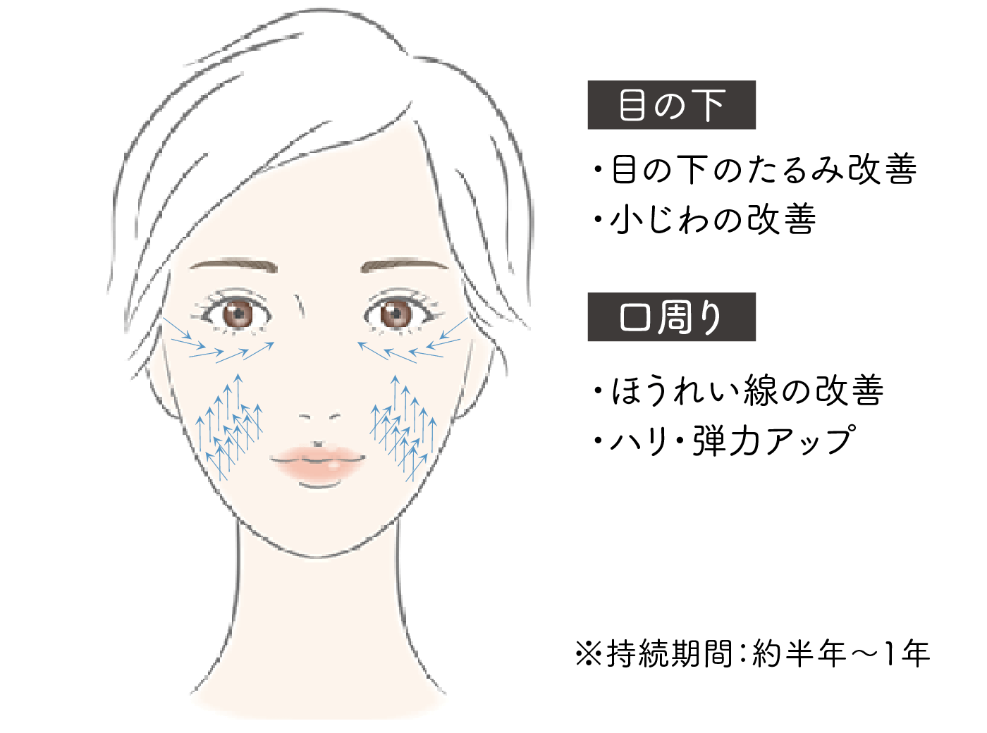 独自の挿入法イメージ画像